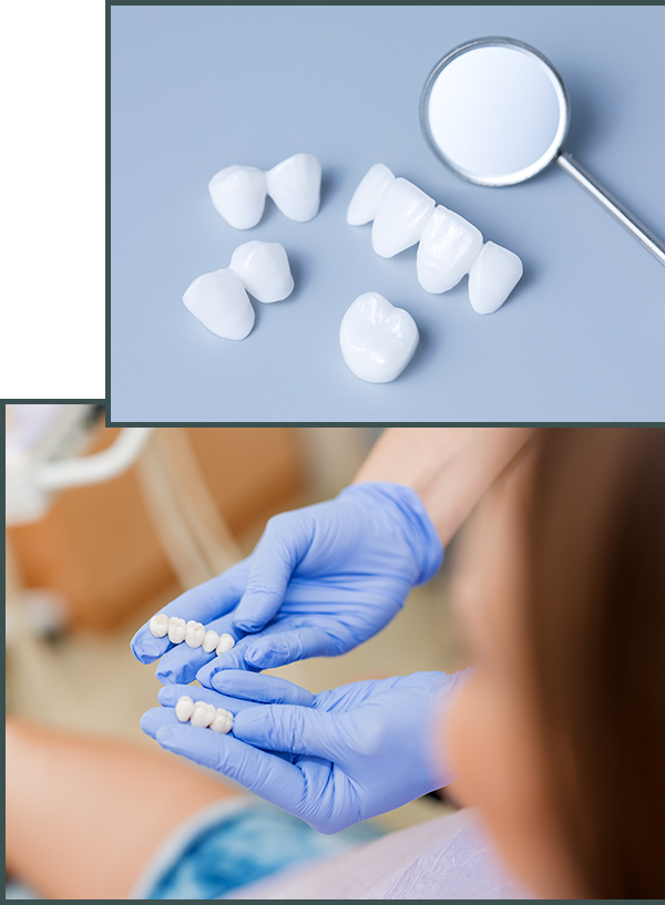Dental Crowns services in Dental Providence RI