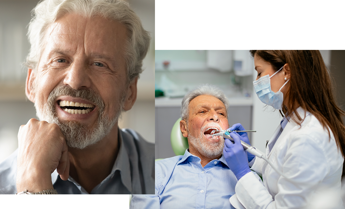 Comfort Dental Providence RI Dental Bonding