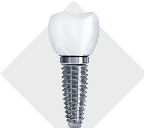 Dental Implants at Comfort Dental Providence RI
