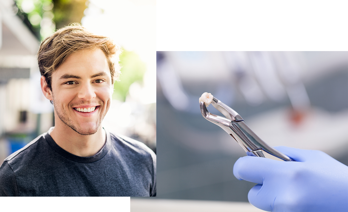 Comfort Dental Providence RI Wisdom Teeth Removal